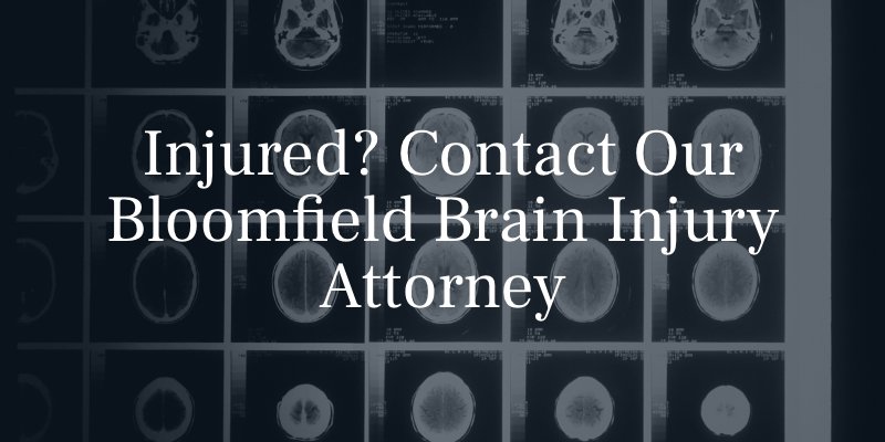 Bloomfield Brain Injury Attorney